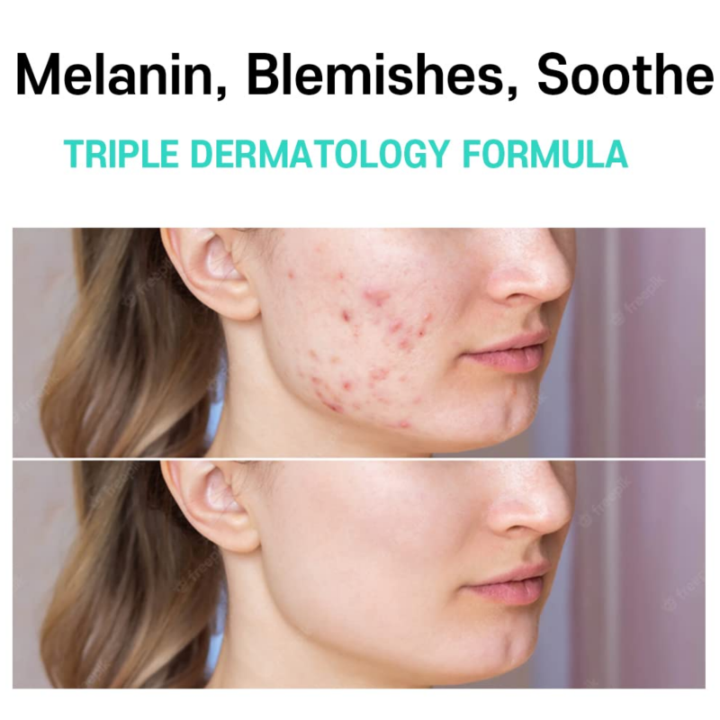 Care:Nel Anti-Melasma Cica Cream 40ml