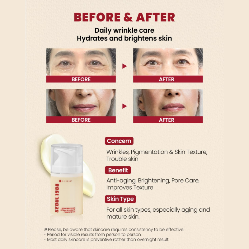 KSECRET SEOUL 1988 Cream : Retinal Liposome 1% + Fermented Rice 50ml