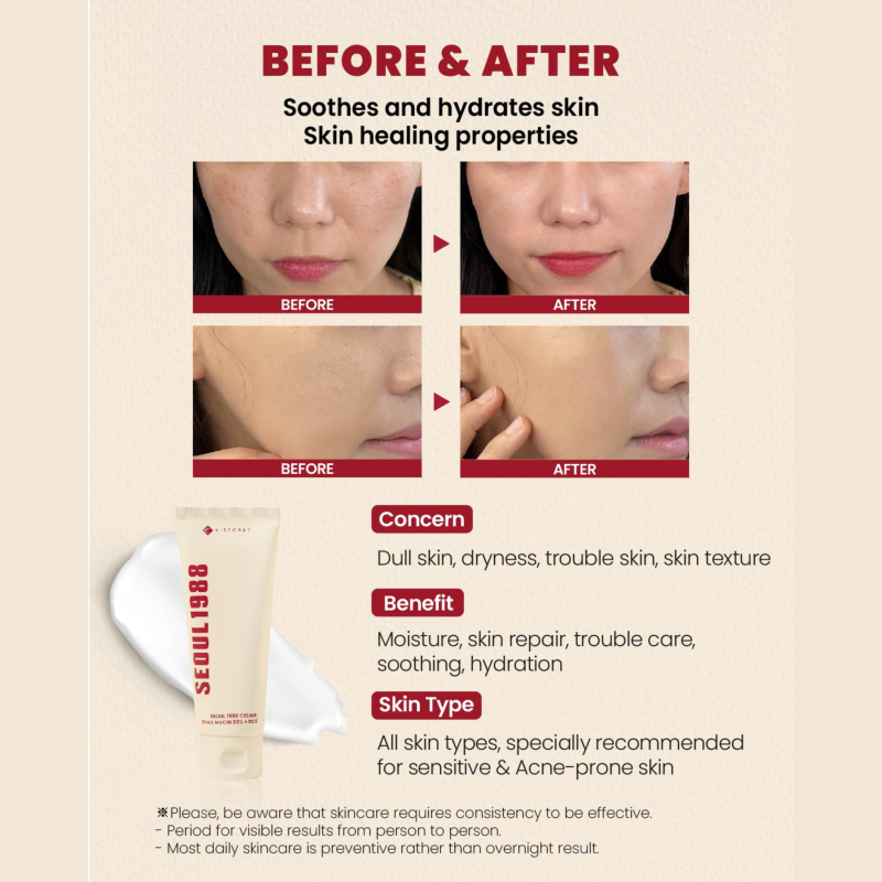 ksecret Seoul 1988 Cream : Snail Mucin 93+Rice 100ml