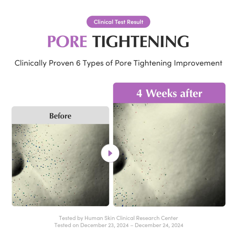 Eqqualberry Purple PDRN Pore Minimizing Serum 30ml