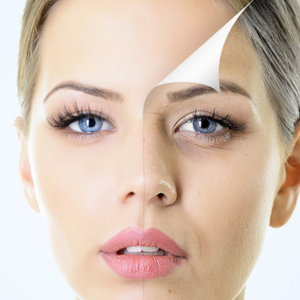 Anti Aging/ Wrinkle Care